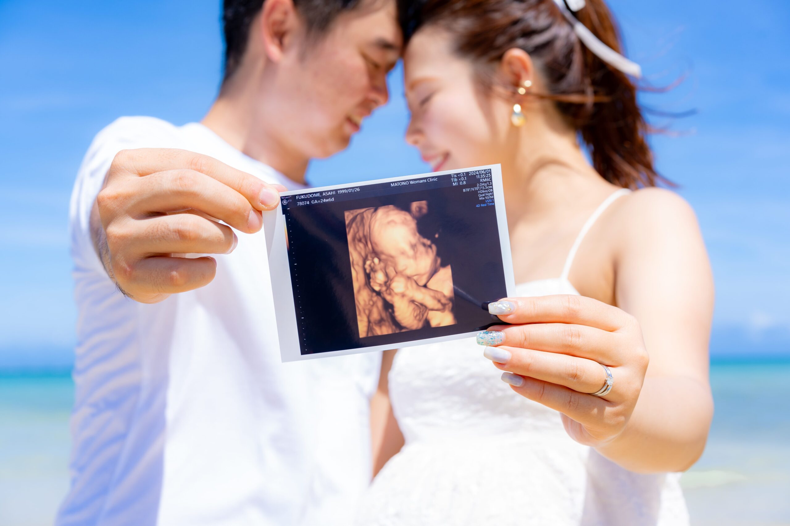 青い海を背景に、寄り添うカップルが赤ちゃんのエコー写真を手前に掲げているマタニティフォト。